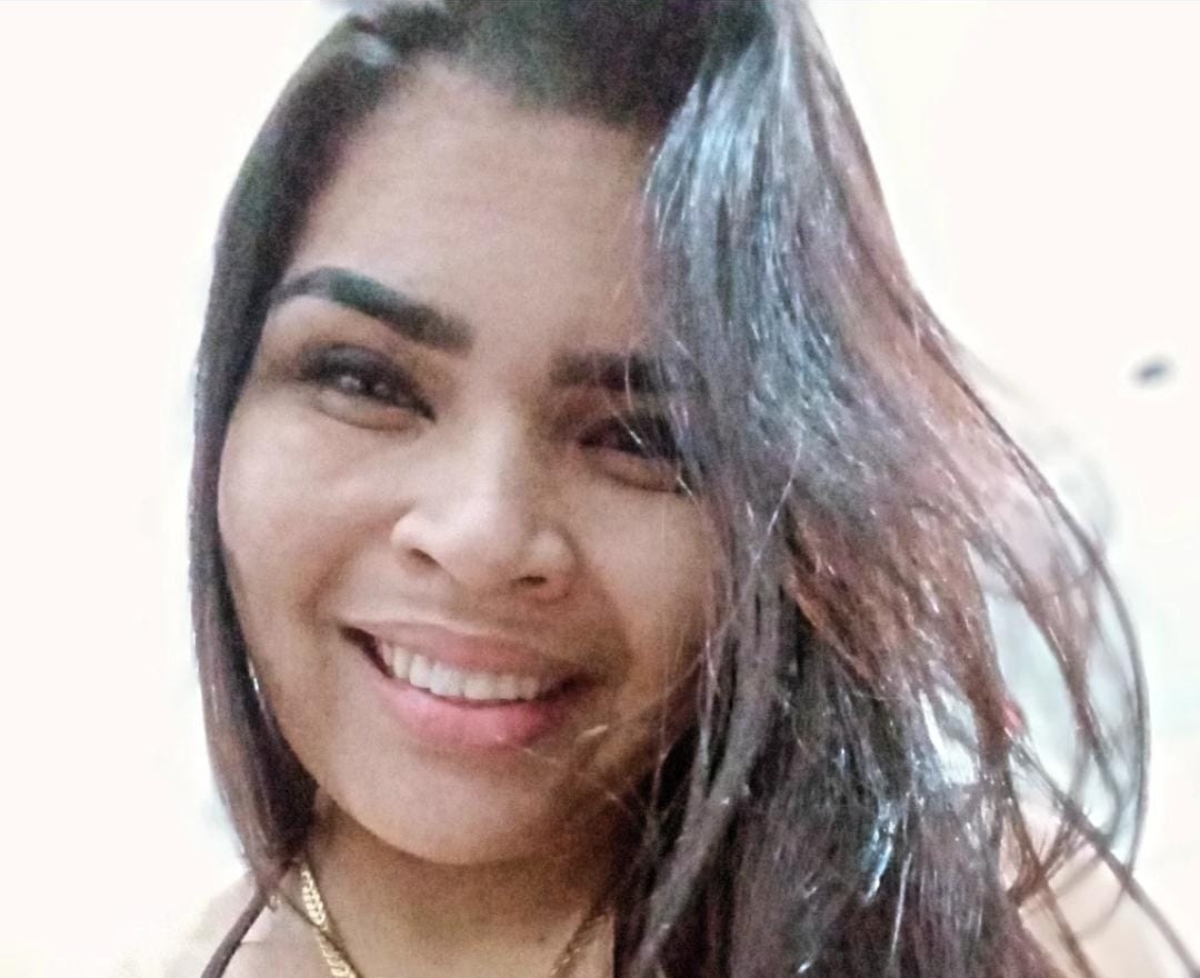 Mulher tem 75% do corpo queimado após ser incendiada pelo ex-companheiro em Cubatão