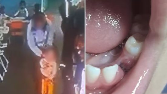 Imagem de monitoramento relacionada ao incidente com criança em escola municipal de Peruíbe